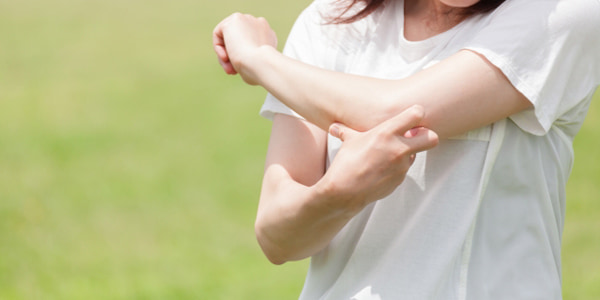 蚊に刺された女性
